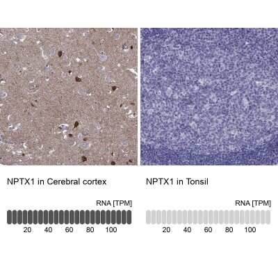 Immunohistochemistry-Paraffin: Neuronal Pentraxin 1 Antibody [NBP2-62710]