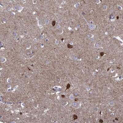 Immunohistochemistry-Paraffin: Neuronal Pentraxin 1 Antibody [NBP2-62710]