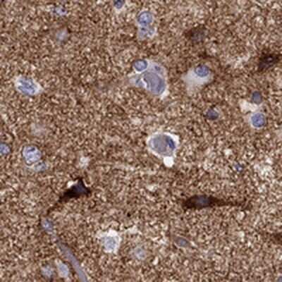 Immunohistochemistry-Paraffin: Neuronal Pentraxin 1 Antibody [NBP2-62710]