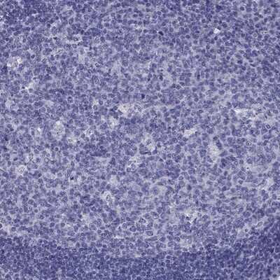 Immunohistochemistry-Paraffin: Neuronal Pentraxin 1 Antibody [NBP2-62710]