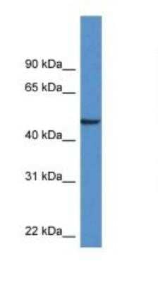 Western Blot: Neuronal Pentraxin 1 Antibody [NBP1-79764]