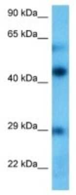 Western Blot: Neuronal Pentraxin 1 Antibody [NBP3-09979]