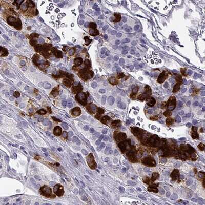 Immunohistochemistry-Paraffin: Neuronal Pentraxin 2 Antibody [NBP2-38609]