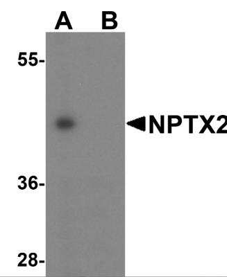 Western Blot: Neuronal Pentraxin 2 AntibodyBSA Free [NBP1-76899]