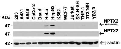 Western Blot: Neuronal Pentraxin 2 AntibodyBSA Free [NBP1-76899]