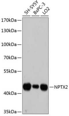 Western Blot: Neuronal Pentraxin 2 AntibodyAzide and BSA Free [NBP2-93755]