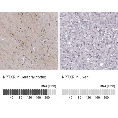 Immunohistochemistry-Paraffin: Neuronal Pentraxin R/NPTXR Antibody [NBP1-86531]