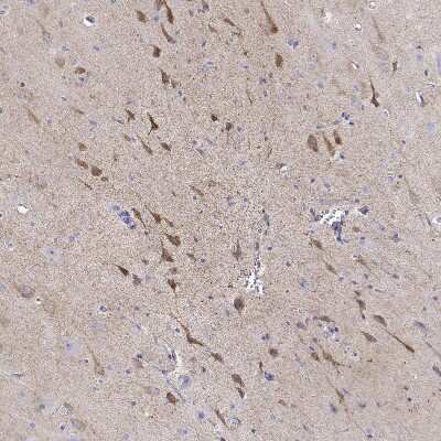 Immunohistochemistry-Paraffin: Neuronal Pentraxin R/NPTXR Antibody [NBP1-86531]