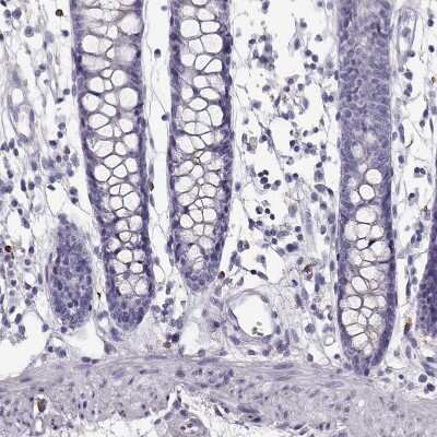 Immunohistochemistry-Paraffin: Neuronal Pentraxin R/NPTXR Antibody [NBP1-86531]