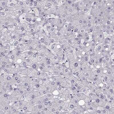 Immunohistochemistry-Paraffin: Neuronal Pentraxin R/NPTXR Antibody [NBP1-86531]