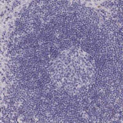 Immunohistochemistry-Paraffin: Neuronal Pentraxin R/NPTXR Antibody [NBP1-86531]