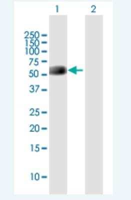 Western Blot: Neuronal Pentraxin R/NPTXR Antibody [H00023467-B01P-50ug]