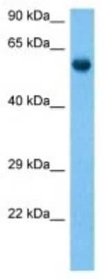 Western Blot: Neuronal Pentraxin R/NPTXR Antibody [NBP3-10142]