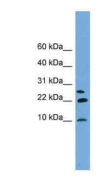 Western Blot: Neuronatin Antibody [NBP1-57015]