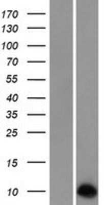 Western Blot: Neuronatin Overexpression Lysate [NBP2-04902]