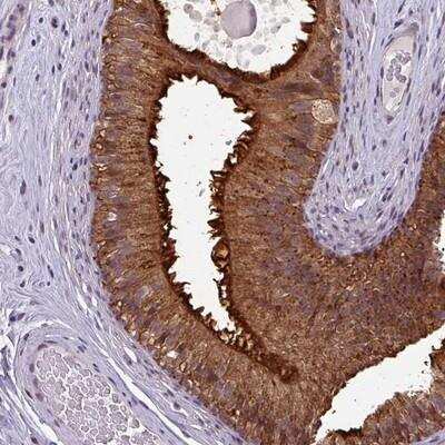 Immunohistochemistry: Neuropeptide FF R1/NPFFR1 Antibody [NBP2-13671]