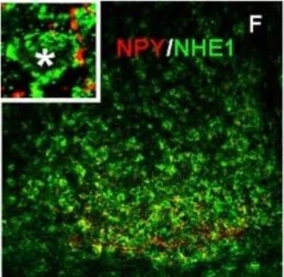 Immunohistochemistry: Neuropeptide Y Antibody [NBP1-46535]