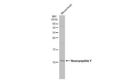 Western Blot: Neuropeptide Y Antibody [NBP3-13163]