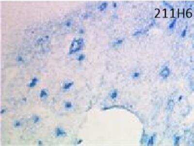 Immunohistochemistry: Neuropilin-1 Antibody (211H6.01) [DDX0440P-100]