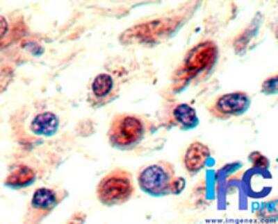 Immunohistochemistry-Paraffin: Neuropilin-1 Antibody [NBP2-24617]