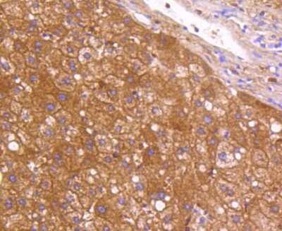 Immunohistochemistry-Paraffin: Neuropilin-1 Antibody (ST05-30) [NBP2-67539]