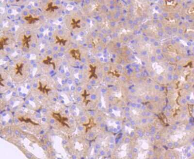Immunohistochemistry-Paraffin: Neuropilin-1 Antibody (ST05-30) [NBP2-67539]