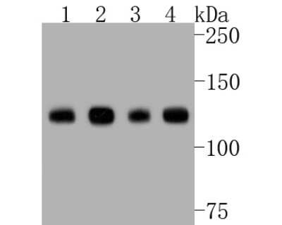 Western Blot: Neuropilin-1 Antibody (ST05-30) [NBP2-67539]