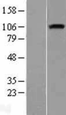 Western Blot: Neuropilin-1 Overexpression Lysate [NBL1-13798]