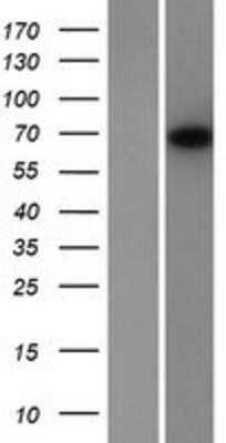 Western Blot: Neuropilin-1 Overexpression Lysate [NBP2-11227]