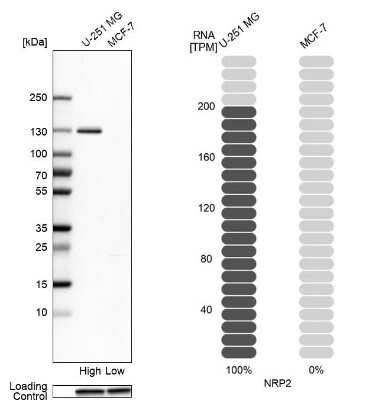 Western Blot: Neuropilin-2 Antibody [NBP2-58804]