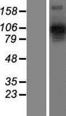 Western Blot: Neuropilin-2 Overexpression Lysate [NBP2-04605]