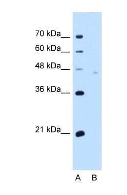 Western Blot: Neuroplastin Antibody [NBP1-62423]