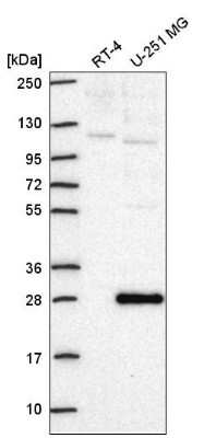 Western Blot: Neuroplastin Antibody [NBP2-56293]