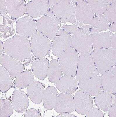 Immunohistochemistry-Paraffin: Neurotensin Antibody [NBP2-33903]