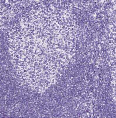 Immunohistochemistry-Paraffin: Neurotensin Antibody [NBP2-33903]