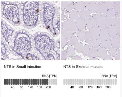 Immunohistochemistry-Paraffin: Neurotensin Antibody [NBP2-33903]