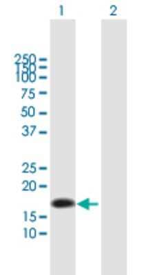 Western Blot: Neurotensin Antibody [H00004922-B01P]