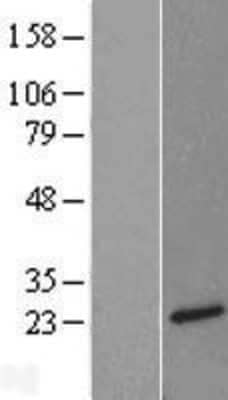 Western Blot: Neurotensin Overexpression Lysate [NBL1-13841]