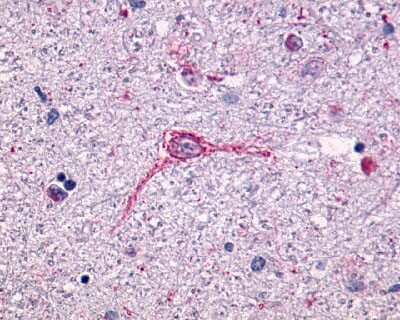 Immunohistochemistry-Paraffin: NTS1/NTSR1 Antibody - BSA Free [NLS935]