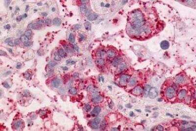 Immunohistochemistry-Paraffin: NTS1/NTSR1 Antibody - BSA Free [NLS938]