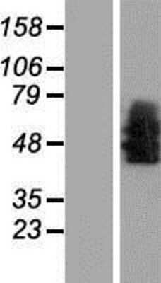 Western Blot: NTS1/NTSR1 Overexpression Lysate [NBP2-10833]