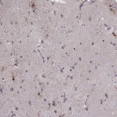 Immunohistochemistry-Paraffin: NT-3 Antibody [NBP2-38196]