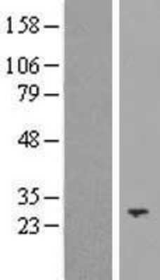 Western Blot: NT-3 Overexpression Lysate [NBP2-10835]