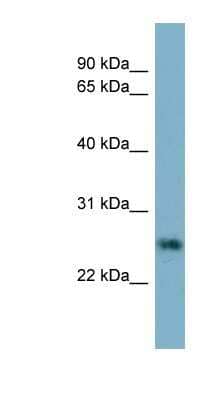 Western Blot: NT-4 Antibody [NBP1-59313]