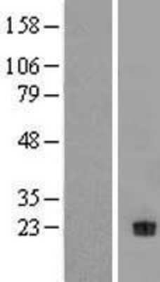 Western Blot: NT-4 Overexpression Lysate [NBL1-13830]