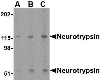 Western Blot: Neurotrypsin AntibodyBSA Free [NBP1-76784]