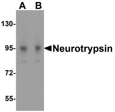 Western Blot: Neurotrypsin AntibodyBSA Free [NBP1-76784]