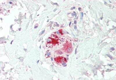 Immunohistochemistry-Paraffin: Neurturin Antibody [NBP1-06057]