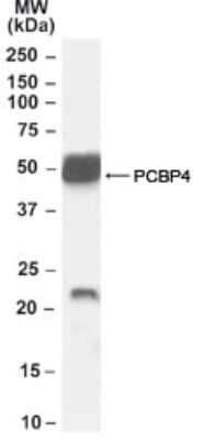 Western Blot: Neurturin Antibody [NB100-68153]