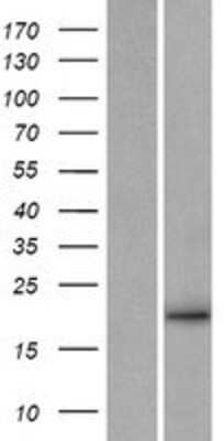 Western Blot: Neurturin Overexpression Lysate [NBP2-10529]